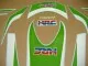 Honda CBR 1000RR 2008-2011 - Lime-Grün/Weiß - Custom-Dekorset